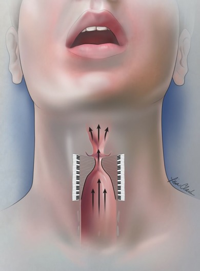Illustration by Lisa A. Clark, MA, CMI, based on original art concept by Kanako Omichi and Tobias Riede. Copyright 2016 Ingo R. Titze, Tobias Riede, and Ted Mau